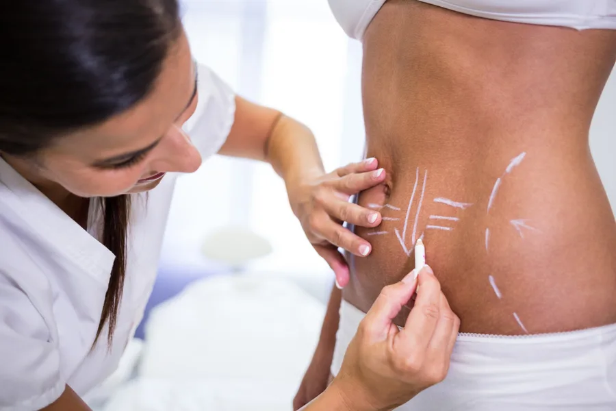 Relaxed patient resting during a non-surgical fat-reduction session