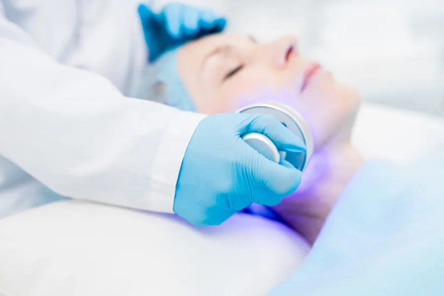 Clear, calm skin after LED light therapy for acne