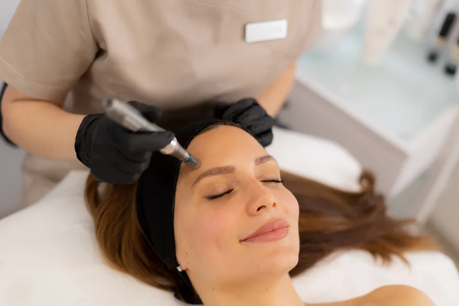 Microneedling with PRF enhancement at Kenzi MedSpa