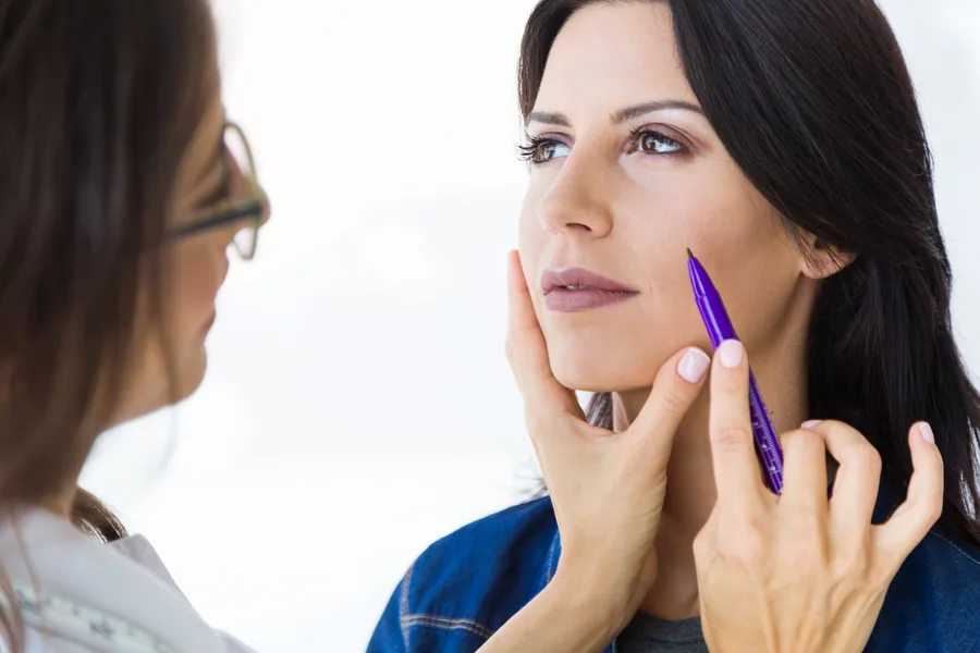 Collagen stimulation following a PDO Thread Lift